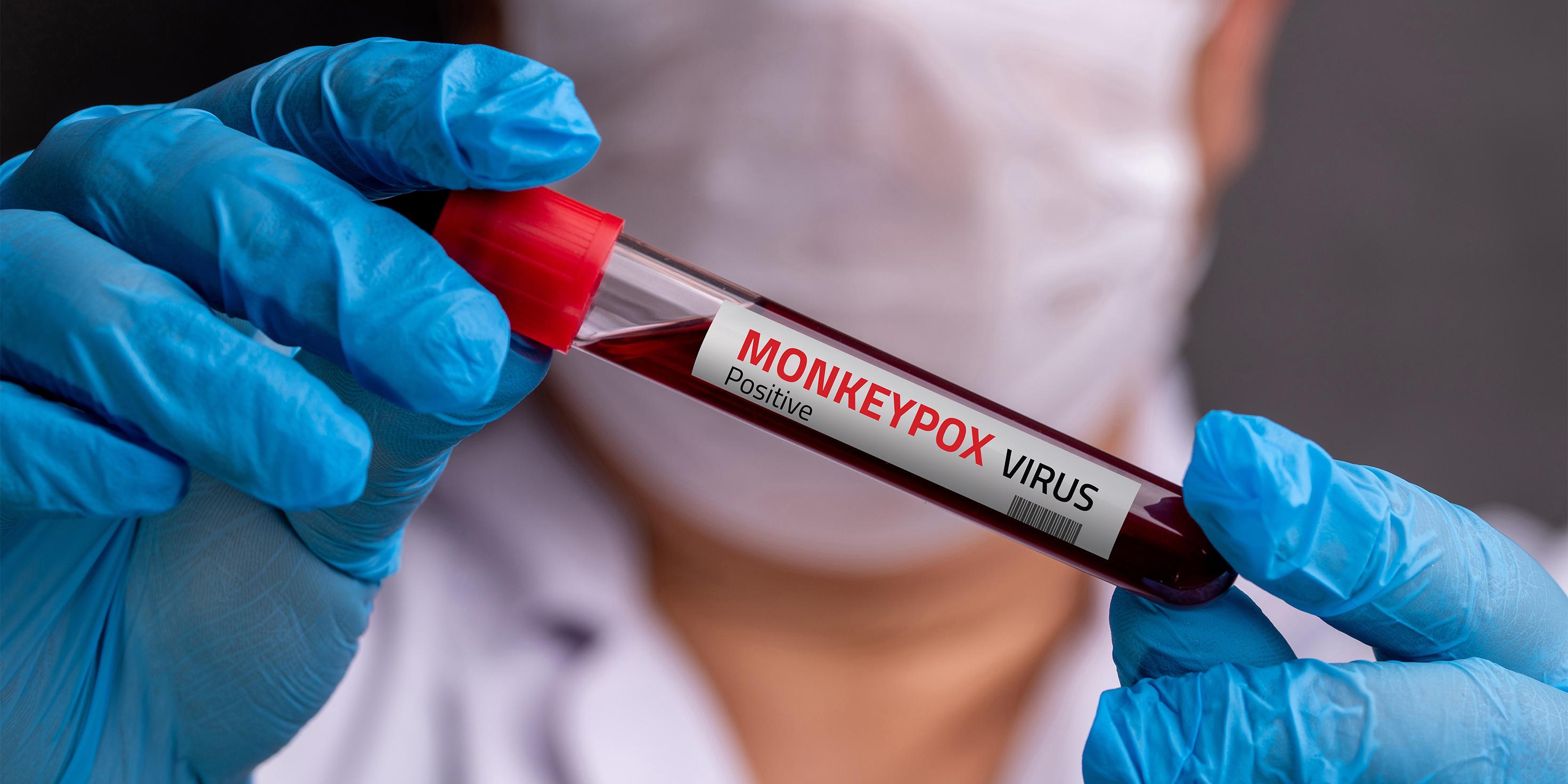How to Address the Potential Monkeypox Pandemic?